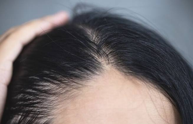 掉髮原因 掉髮原因