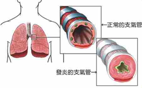 戒煙呼吸改善 戒煙呼吸改善