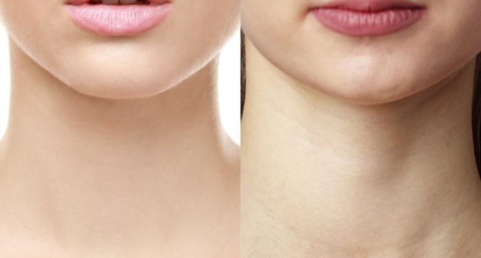 頸部保養 頸部保養