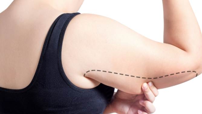 手臂減肥運動 手臂減肥運動