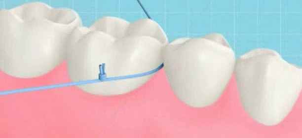 牙线使用方法 牙线使用方法