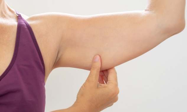 消除蝴蝶袖 消除蝴蝶袖