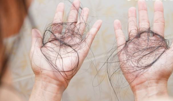 掉髮原因與預防 掉髮原因與預防