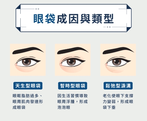 眼袋原因