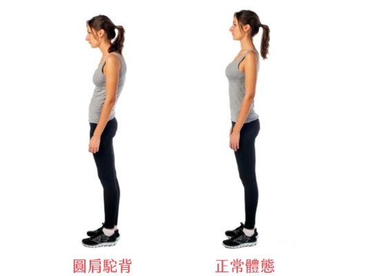 圓肩症狀 圓肩症狀