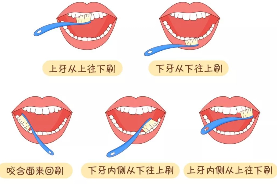 牙齒保健誤區 牙齒保健誤區