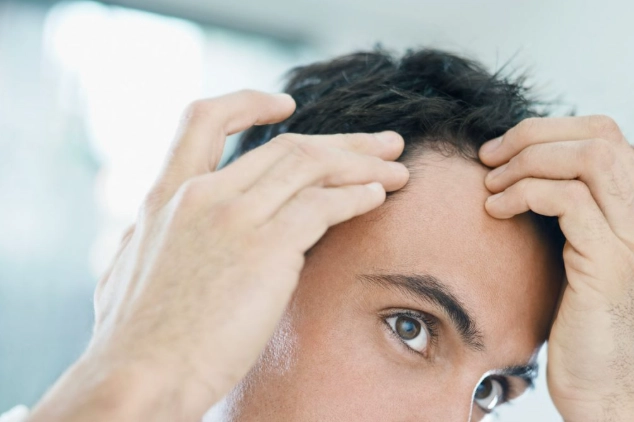 男性掉髮因素