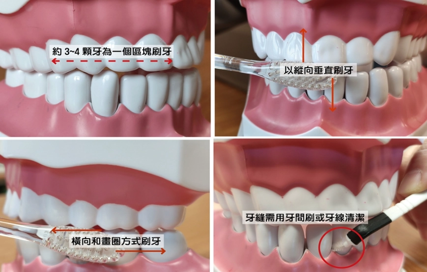 牙齒清潔方法 牙齒清潔方法