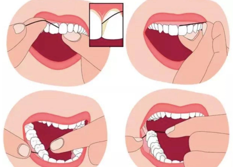牙線教學 牙線教學