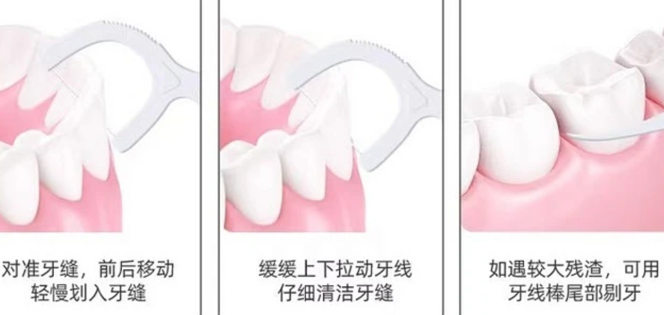 牙線正確使用方法 牙線正確使用方法