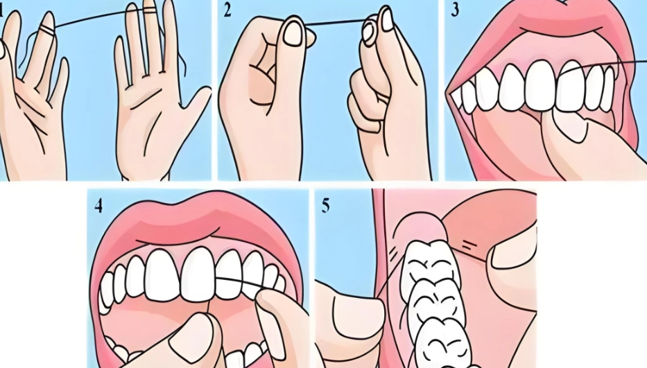 牙線多久用一次