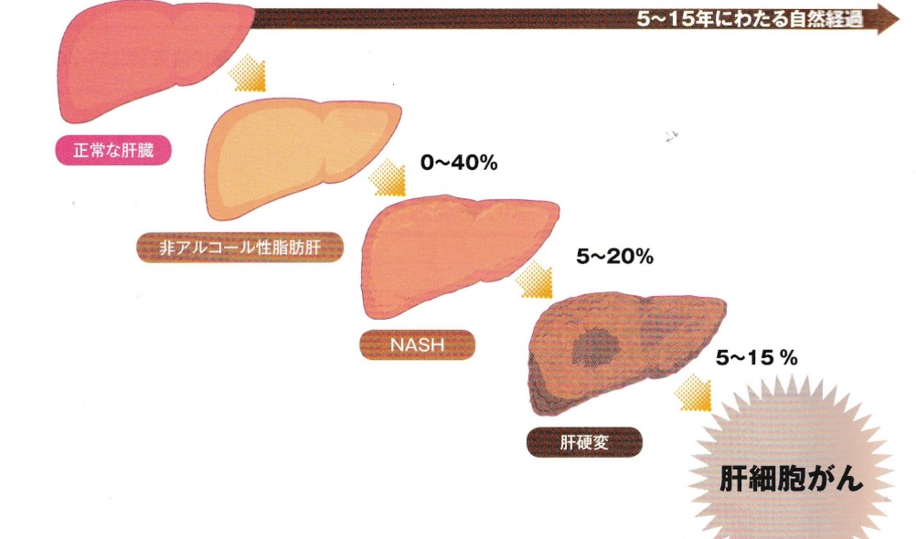 肝經調理 肝經調理