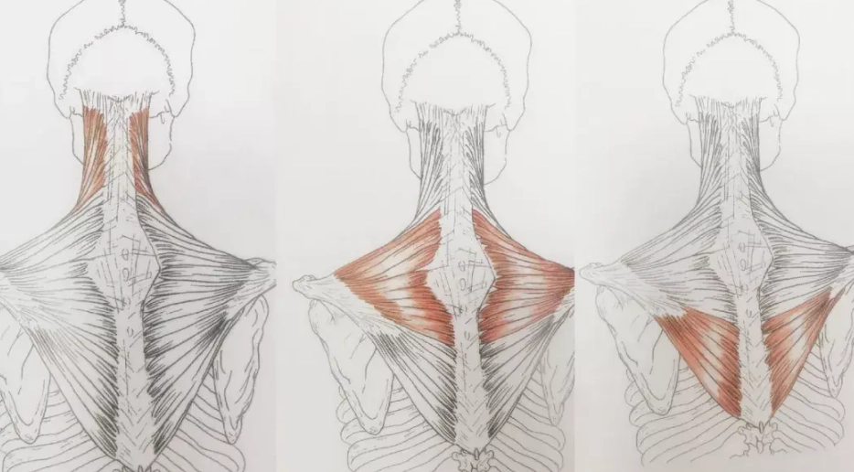 斜方肌疼痛治療