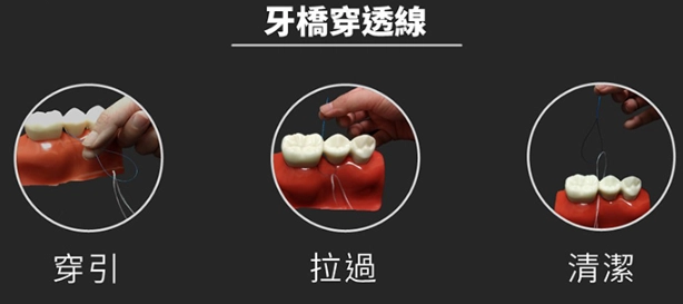 牙齦萎縮原因 牙齦萎縮原因