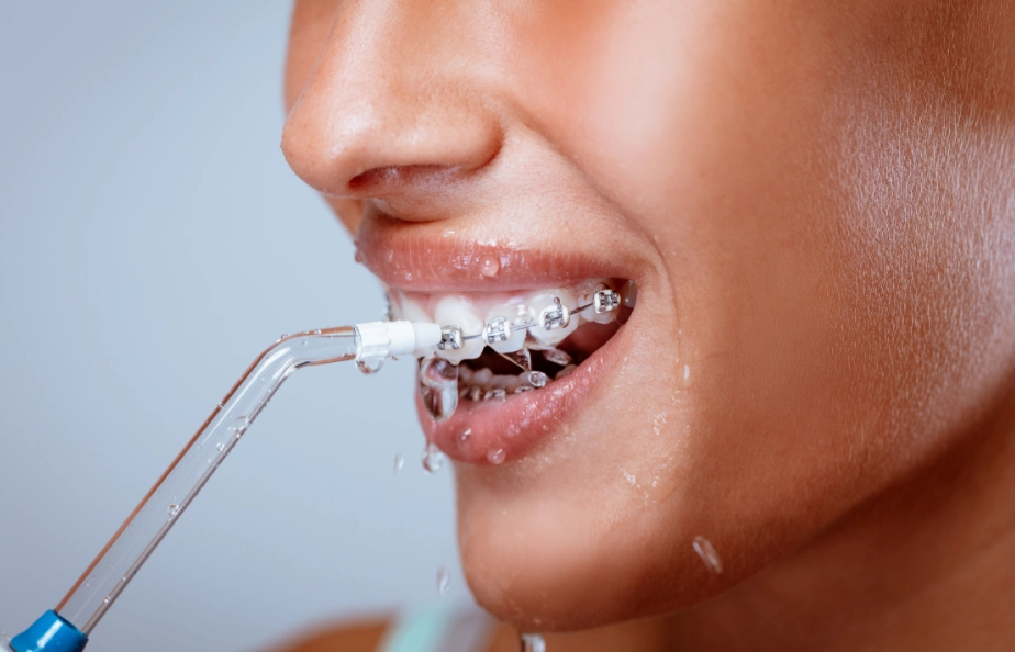 水牙線使用順序 水牙線使用順序