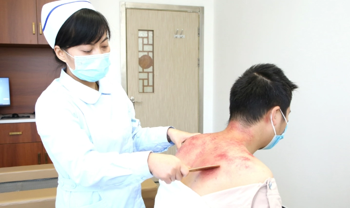 飲酒後刮痧安全嗎