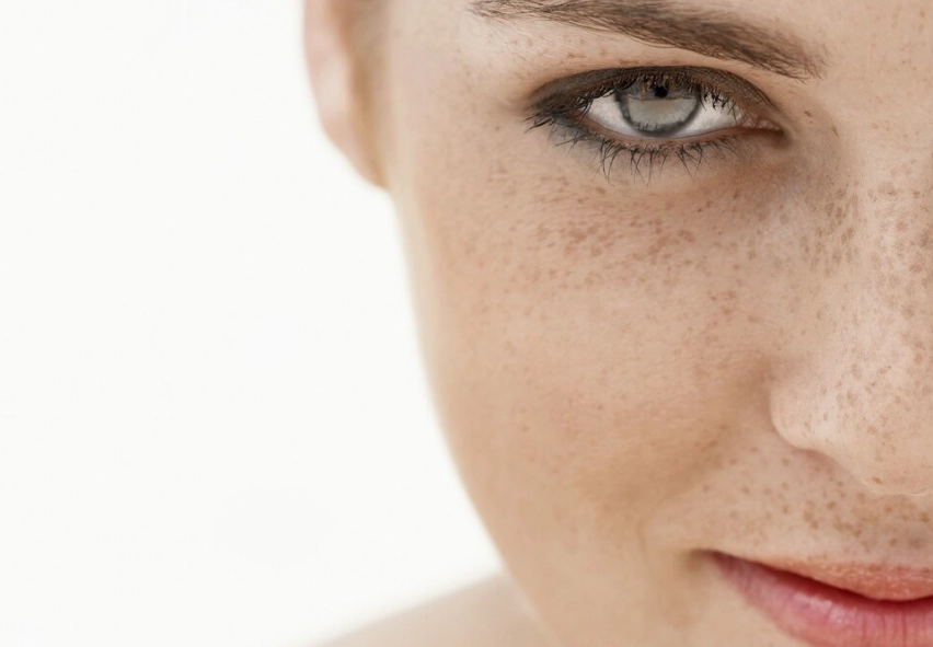 臉上黑黑一塊原因