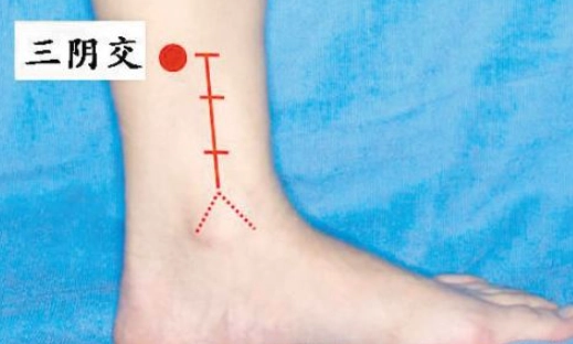 手脚冰冷改善穴位