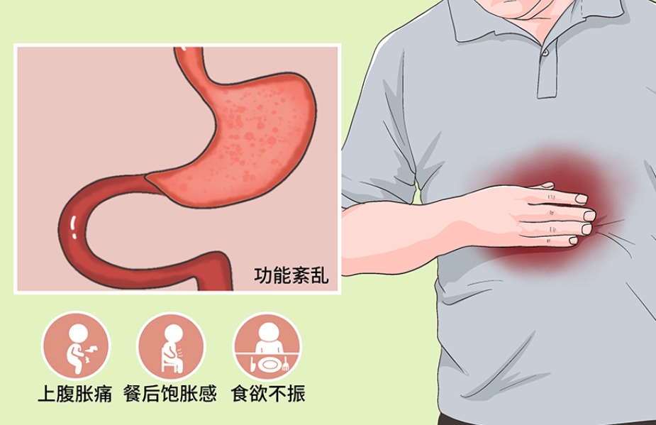 消化不良 恢復時間