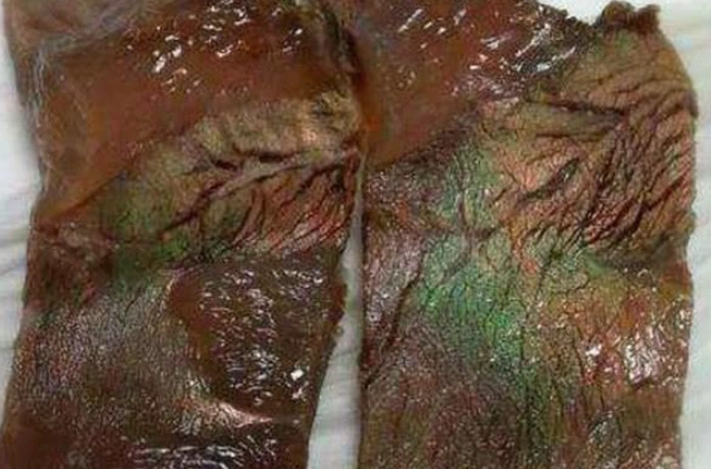 細菌滋生溫度 細菌滋生溫度