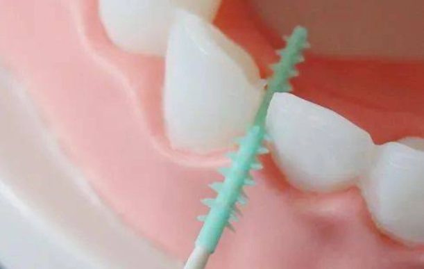 牙縫清潔 牙縫清潔