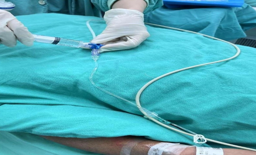 麻醉針痛感 麻醉針痛感