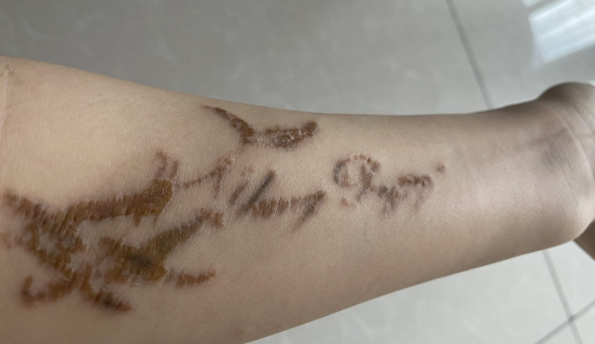 刺青護理方法 刺青護理方法