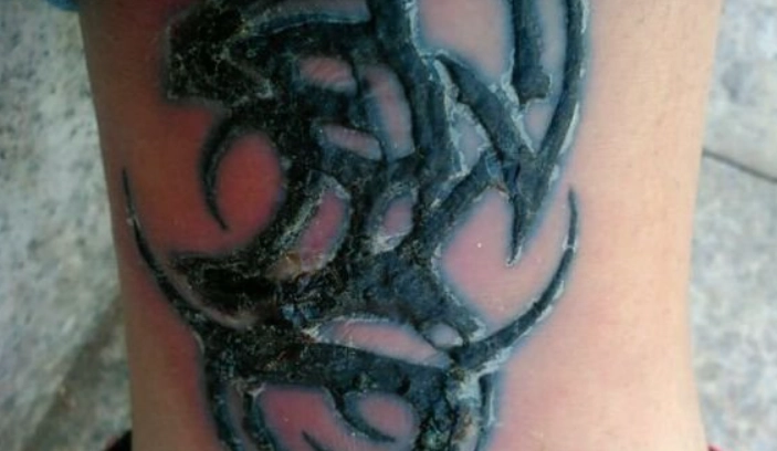 刺青後保養方法 刺青後保養方法