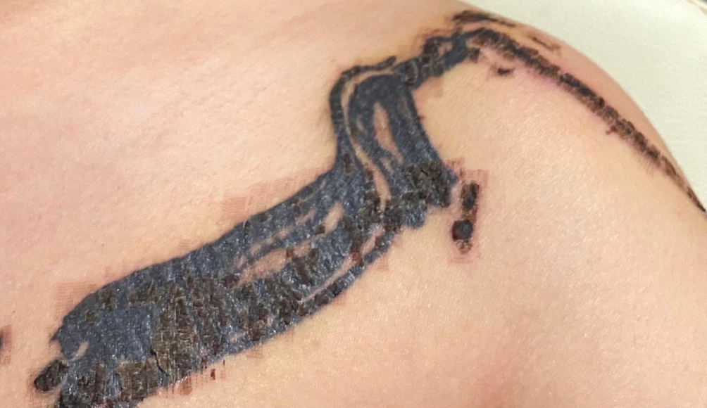 紋身結痂過程 紋身結痂過程