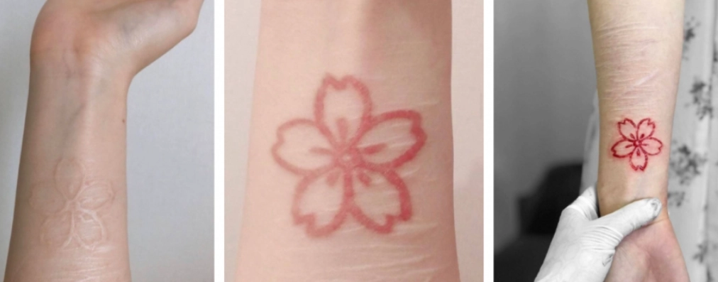 紋身脫皮處理 紋身脫皮處理