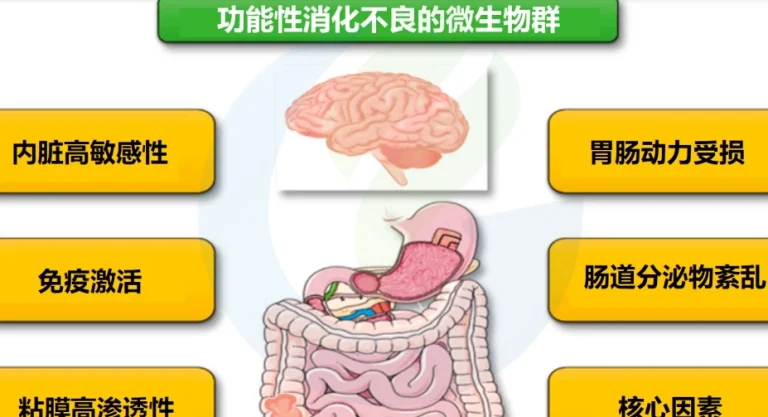 功能性消化不良治療