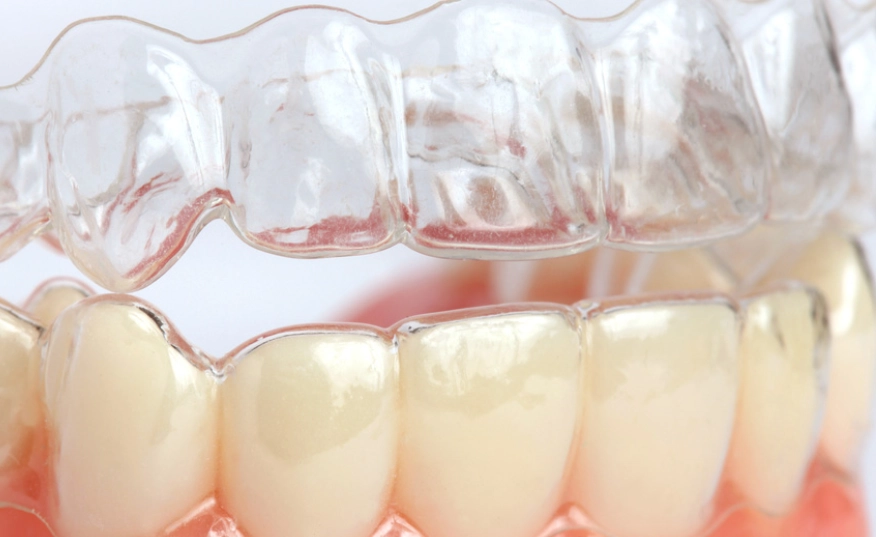 睡覺磨牙治療 睡覺磨牙治療