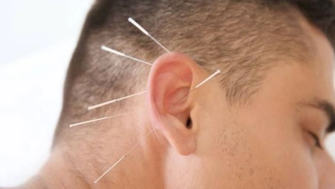 針灸後耳鳴加重