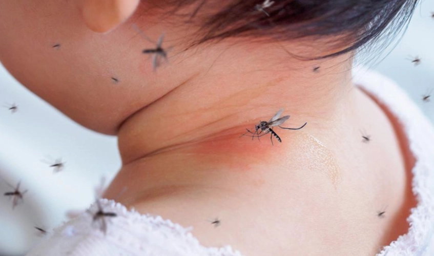 蚊子咬類固醇副作用 蚊子咬類固醇副作用