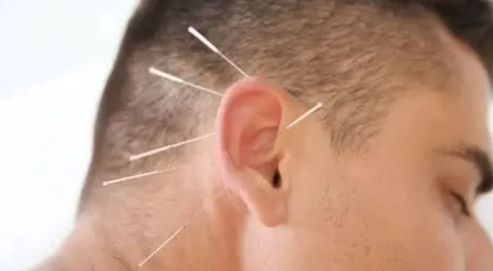 耳鳴看中醫好還是西醫好