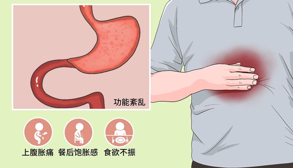 胃部不適治療 胃部不適治療