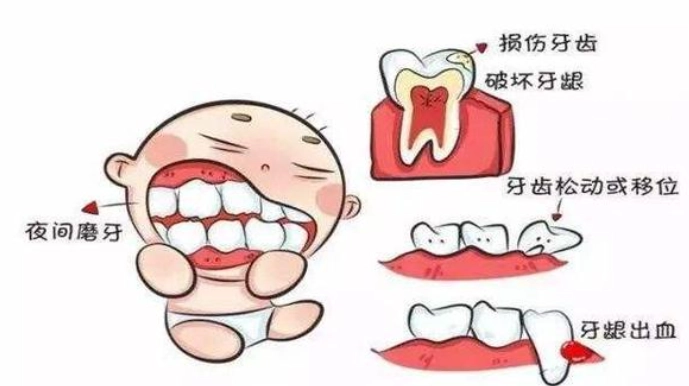 睡覺磨牙治療 睡覺磨牙治療