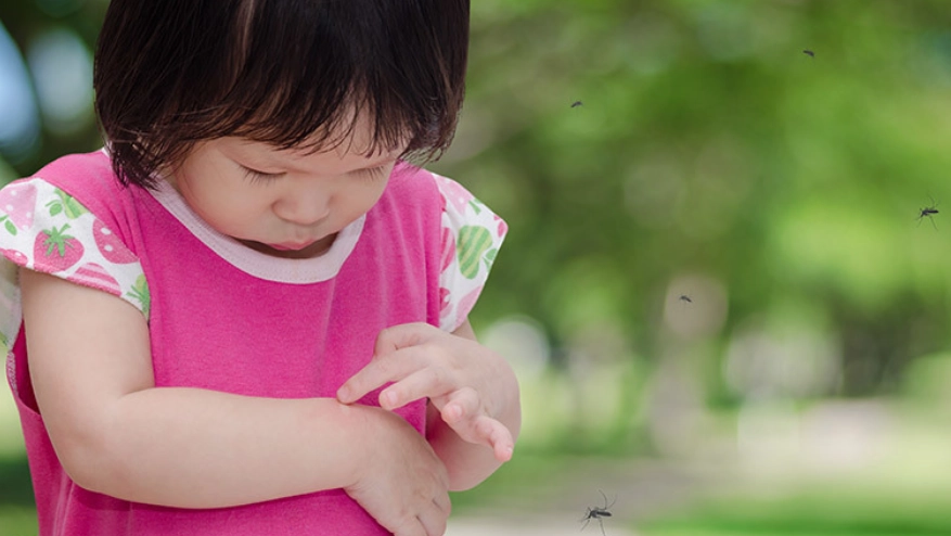 被蚊子叮止癢方法 被蚊子叮止癢方法