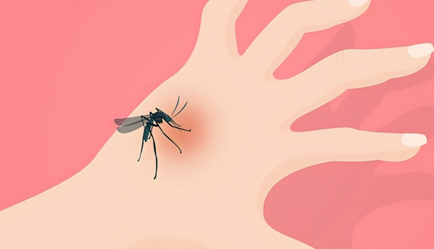 類固醇藥膏蚊子叮 類固醇藥膏蚊子叮