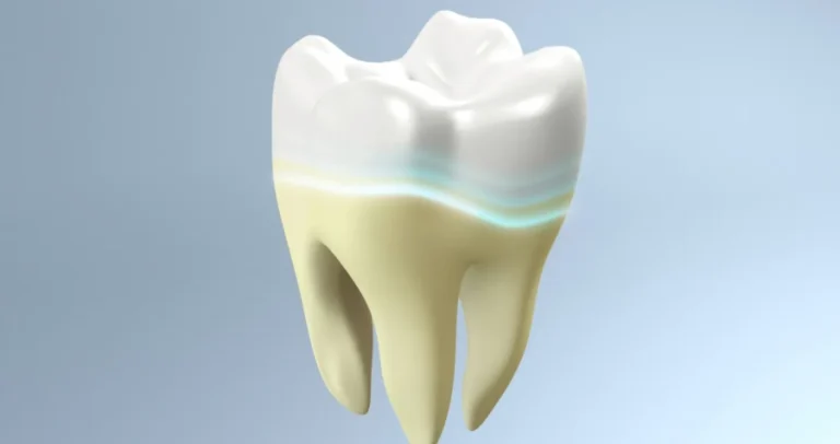 琺瑯質受損症狀