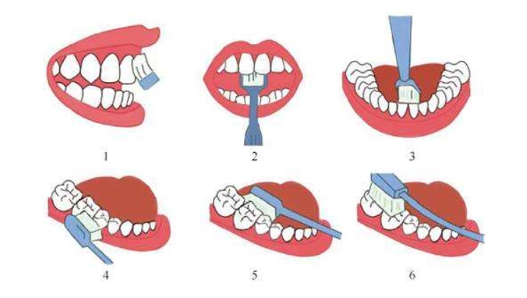 牙齦流血怎麼辦