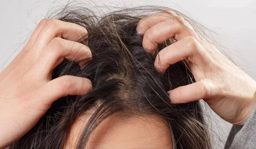 身體癢治療 身體癢治療