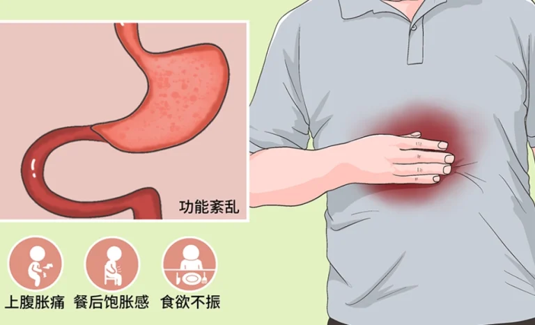 功能性消化不良改善