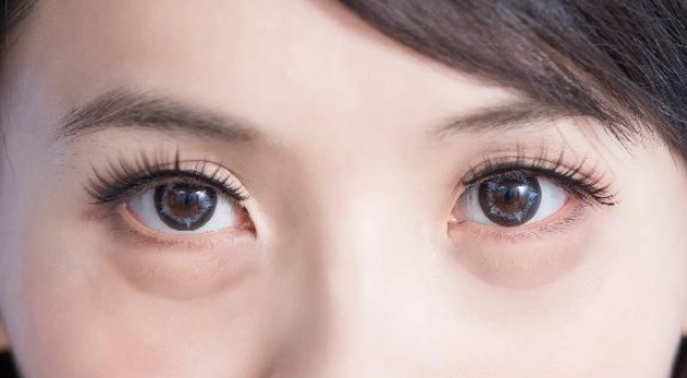 眼袋消除方法