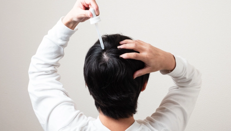 禿頭長頭髮全攻略：有效方法、產品推薦與疑難解答