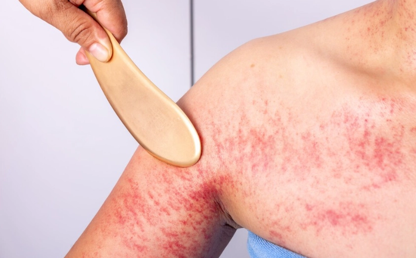 心臟痛刮痧安全嗎？專家解析風險、正確步驟與常見誤區