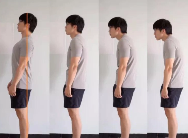 改善駝背的運動