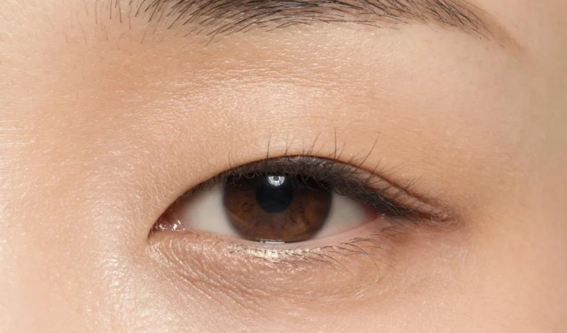蚊子眼皮全攻略：薄眼皮成因、護理秘訣與常見問題解答