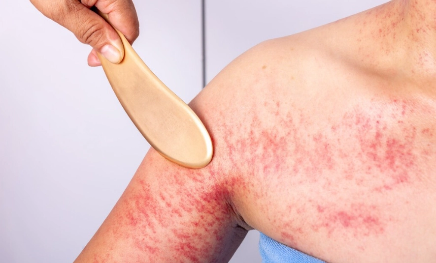 刮痧護理全攻略：好處、技巧與注意事項一次看懂