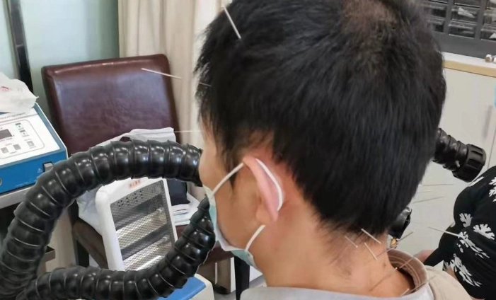 耳鳴看中醫有效嗎